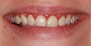 Before Image: Case 400 - front