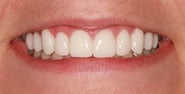 After Image: Case 401 - front