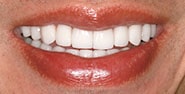 After Image: Case 402 - front