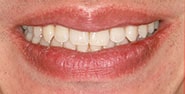 Before Image: Case 402 - front