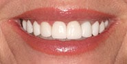 After Image: Case 403 - front