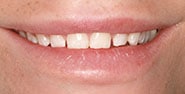 Before Image: Case 405 - front