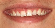 Before Image: Case 407 - front