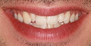 Before Image: Case 408 - front