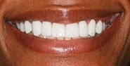 After Image: Case 410 - front