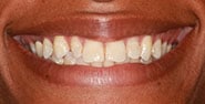 Before Image: Case 410 - front
