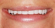 After Image: Case 411 - front