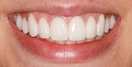 After Image: Case 412 - front