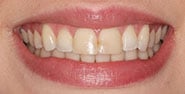 Before Image: Case 412 - front