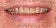 Before Image: Case 413 - front