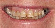 Before Image: Case 414 - front