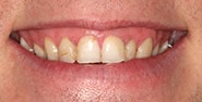 Before Image: Case 416 - front