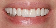 After Image: Case 418 - front