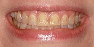 Before Image: Case 418 - front