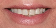 Before Image: Case 419 - front