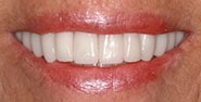 After Image: Case 421 - front