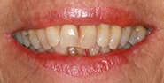 Before Image: Case 421 - front