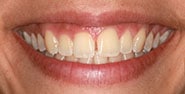 Before Image: Case 422 - front