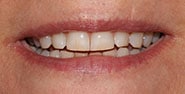Before Image: Case 426 - front