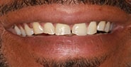 Before Image: Case 427 - front
