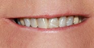 Before Image: Case 431 - front