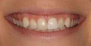 Before Image: Case 436 - front