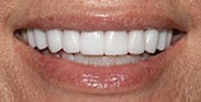 After Image: Case 437 - front