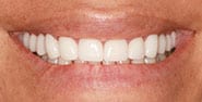 After Image: Case 438 - front
