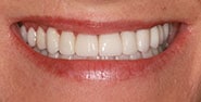 After Image: Case 439 - front