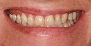 Before Image: Case 439 - front