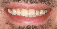 Before Image: Case 440 - front
