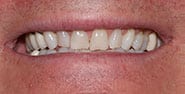 Before Image: Case 441 - front