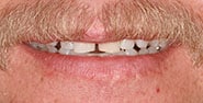 Before Image: Case 446 - front
