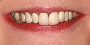 Before Image: Case 447 - front