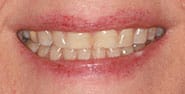 Before Image: Case 448 - front