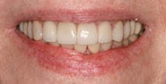 Before Image: Case 449 - front