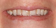 Before Image: Case 451 - front