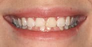 Before Image: Case 453 - front