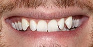 Before Image: Case 456 - front