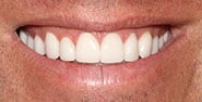 After Image: Case 457 - front