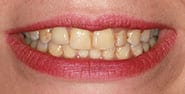 Before Image: Case 459 - front