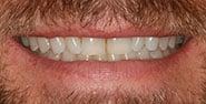 Before Image: Case 460 - front