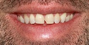 Before Image: Case 463 - front