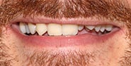 Before Image: Case 465 - front