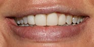 Before Image: Case 467 - front