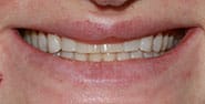 Before Image: Case 468 - front