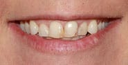 Before Image: Case 469 - front