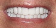 After Image: Case 470 - front