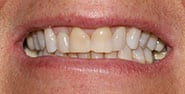 Before Image: Case 470 - front