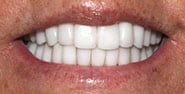 After Image: Case 471 - front
